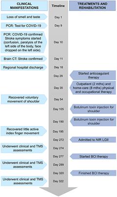 A case report: Upper limb recovery from stroke related to SARS-CoV-2 infection during an intervention with a brain-computer interface